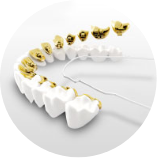Incognito braces are contoured to hug the lingual (tongue-side) surfaces of your teeth. These braces are customised with intelligent wires and brackets that are engineered to deliver effective results.